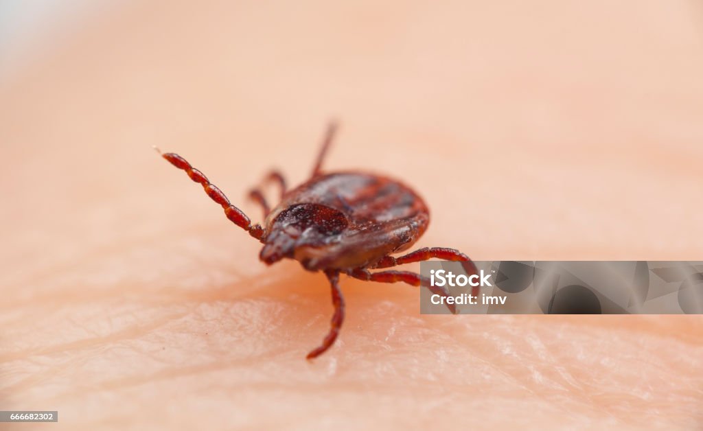 European dog’s tick on human skin.